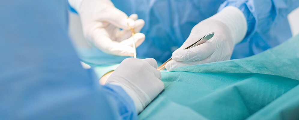 Ablauf der Vasektomie Mannheim - Die OP wird ohne Skalpell durchgeführt, dafür mit einem Spezialinstrument punktiert
